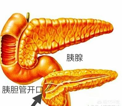 急性胰腺炎的治疗:急性重症胰腺炎能恢复吗？
