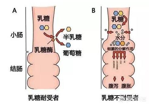 婴儿母乳乳糖不耐受的症状表现:七个月的宝宝乳糖不耐受能自愈吗？