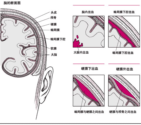 妈妈顺产后颈部有肿块:顺产头部水肿硬化了，还能恢复吗？