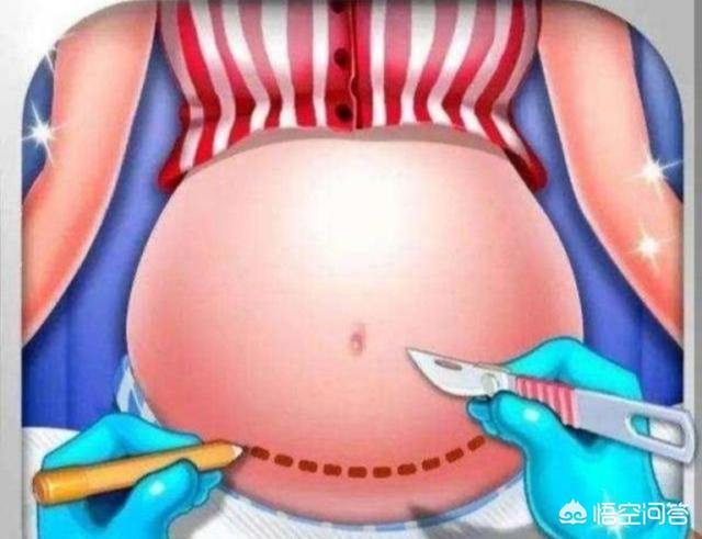 头条问答 - 生完孩子的女性易发胖,是什么原因,如何尽快改正?