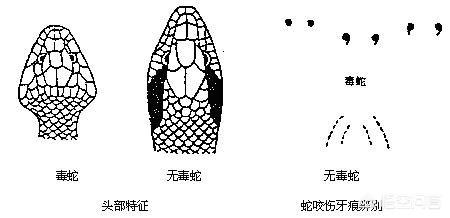 被黑色乌苏里蝮蛇咬了怎么办:被蛇咬了，离医院太远，有什么急救方法？