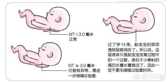 孕12周胎盘见光点怎么回事:12周做NT正常，但是报告胎位前置，该怎么办啊？