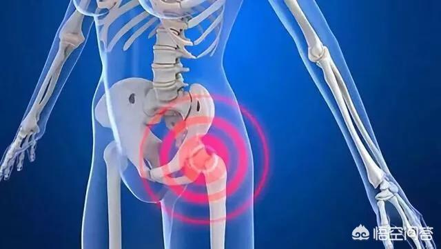 胯骨疼是怎么回事胯骨疼是怎么回事女性该吃什么药