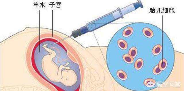 强心脏120306:胎儿心脏彩超多少周做好查出心室强回声是什么原因是畸形吗