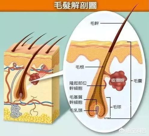 头发皮囊炎脱发:油脂堵塞毛囊会引起脱发吗？