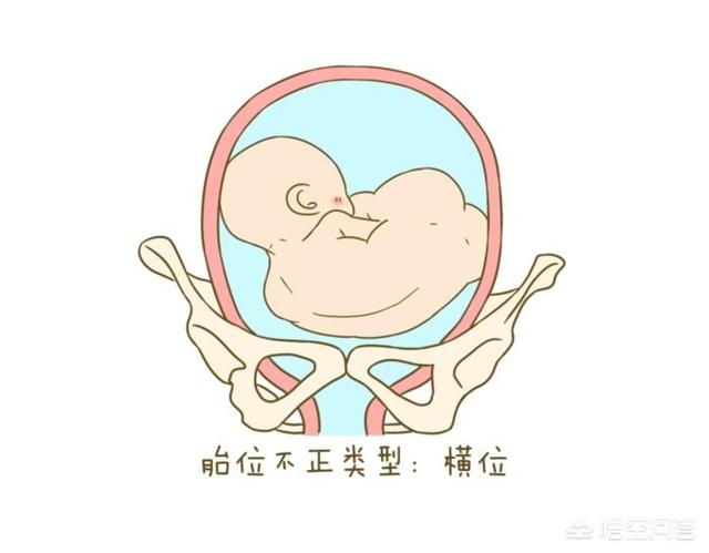头条问答 - 孕34周胎动横位还能转正吗?(6个回答)