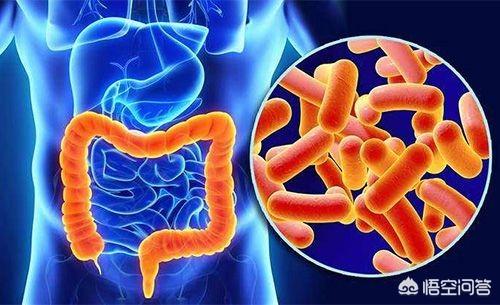 得了结肠炎怎么办:得了结肠炎怎么治疗 一不小心得了结肠炎，该怎么办？