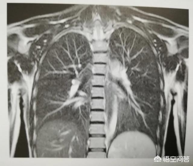 头条问答 核磁共振都可以检查哪里 37个回答
