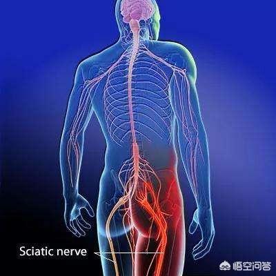 腰間盤膨出療法腰間盤膨出導致腿疼腿麻可以治癒嗎需要注意什麼