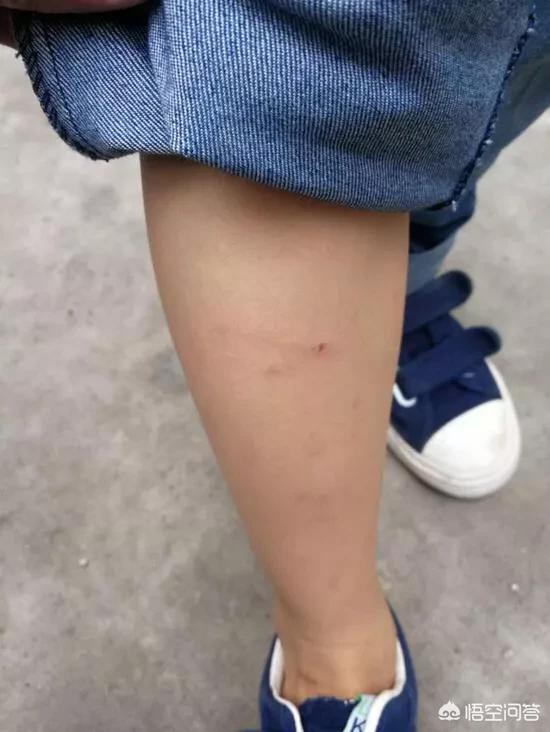 深圳狗狗网怎么了:深圳一狗咬男孩两次，男孩父亲打死狗遭索赔2万, 你怎么看？