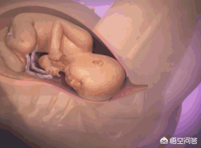 宝宝如何通过产道顺利分娩，胎儿足月了，怎么开宫口快