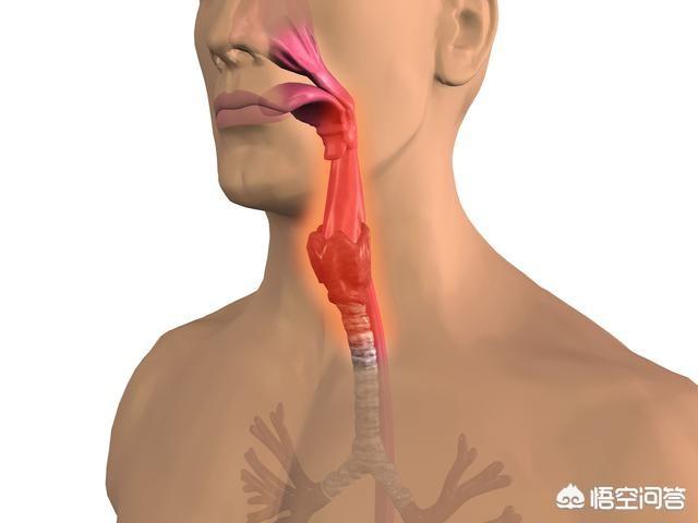 头条问答 - 引起咽喉炎的原因可能有哪些?(9个回答)
