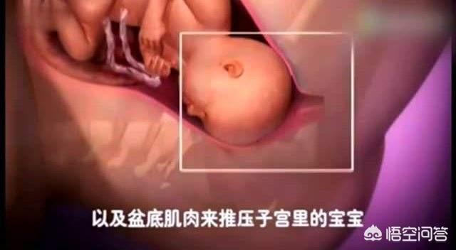 正常分娩产妇护理ppt:顺产和剖腹产该如何选择？剖腹产后怎样护理呢？