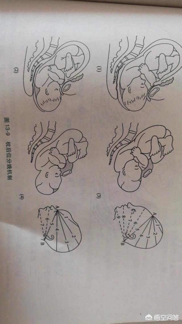 撒尿流白色物质小说:孕34周胎动频繁，小便过后一会有分泌物排出正常吗？