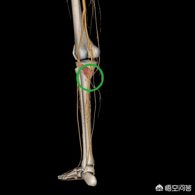走路多膝盖疼小腿关节疼发硬是什么原因