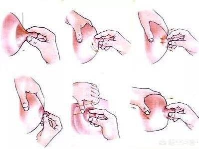 人造乳房(人造乳房大概多少钱)