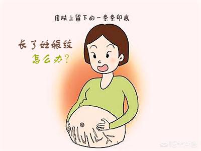 怀孕多久会长妊娠纹？为什么会长妊娠纹？插图23