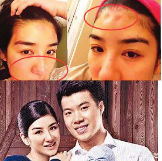 佟丽娅家暴:娱乐圈有哪些被家暴的女明星？