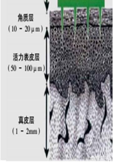 怎么样去痘印，怎么样去痘印最有效的方法