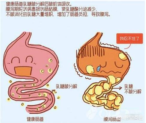 乳糖不耐受症状怎么缓解:五十多天的宝宝，乳糖不耐受拉肚子怎么办？