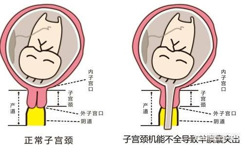 软产道部位图片