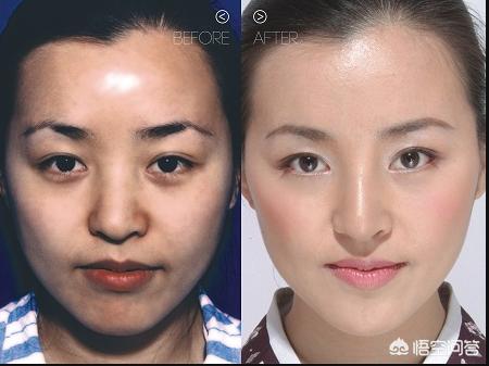 人鼻腔结构图:鼻子的结构是什么样子的？