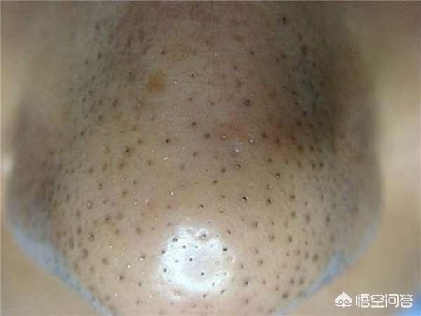 挤狗豆子视频:怎么给狗狗挤肛门腺？多久挤一次？