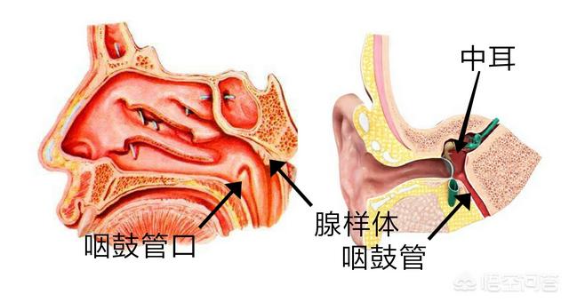 男童感冒后急性中耳炎吃什么药:儿童得了急性中耳炎怎么办？