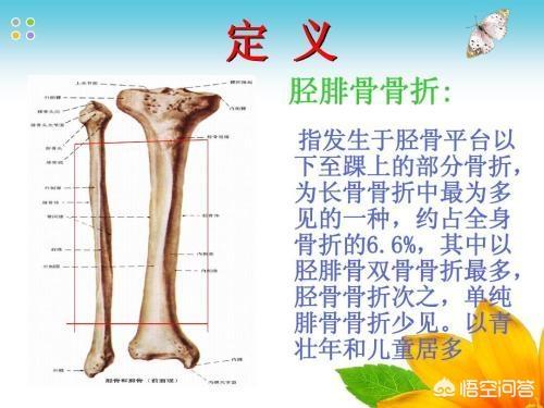 头条问答 努尔基奇胫骨和腓骨折 这会对于他的nba影响有多大 8个回答