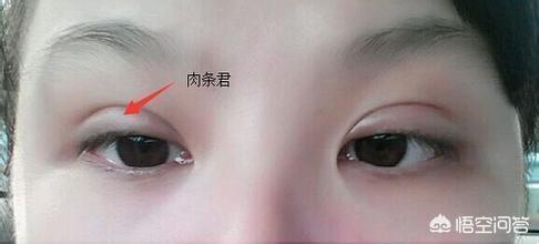 古巨基割双眼皮:对于男生割双眼皮你们怎么看