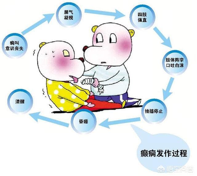 癫痫什么症状:癫疯病什么症状 小儿癫痫都有哪些临床症状？