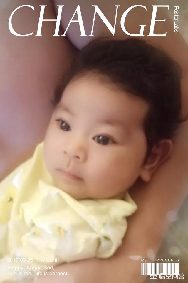 胎毛:新生儿胎毛要不要剃，如何科学的剃？