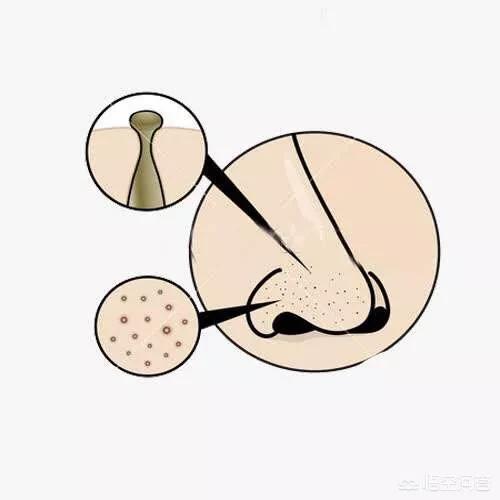 根治毛孔粗大,硫磺皂洗脸对毛孔粗大有用吗？