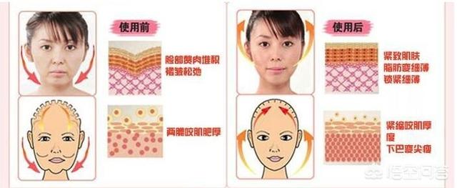 刘涛打瘦脸针面部凹陷，为什么打瘦脸针会出现面部下垂的现象？
