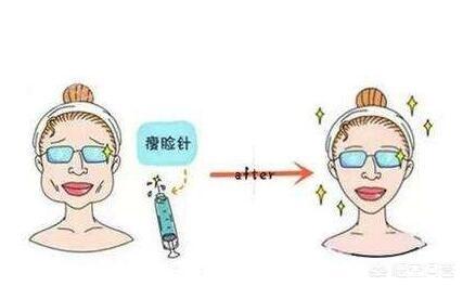 刘涛打瘦脸针面部凹陷，为什么打瘦脸针会出现面部下垂的现象？