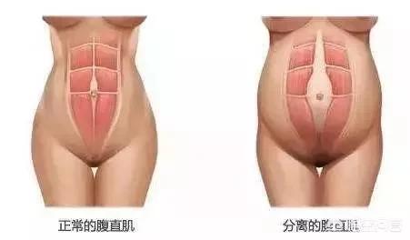 生完孩子以后，做康复训练去产后恢复中心好还是健身房买私教好？