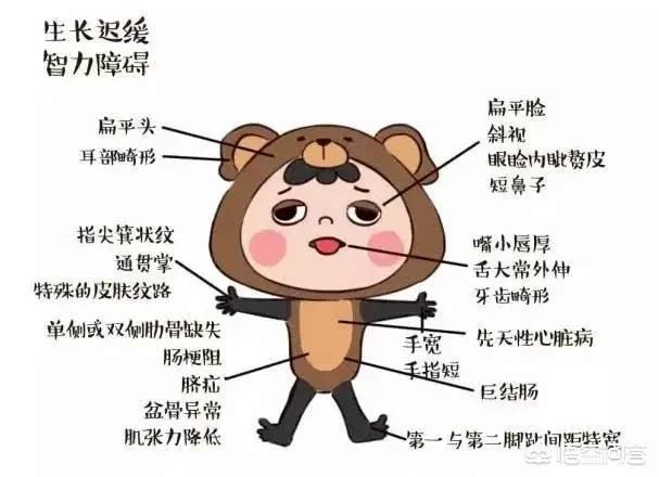 弓形体病:弓形体病症状和治疗 一次产检都没落，为啥还会生出畸形儿？