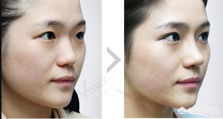 人鼻腔结构图:鼻子的结构是什么样子的？