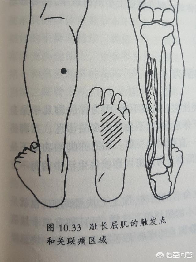 涌泉的准确位置图,按摩刺激涌泉穴有什么好处？