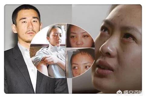 佟丽娅家暴:娱乐圈有哪些被家暴的女明星？