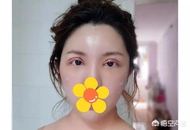 郑柔美整容前后:最早一批做双眼皮手术的人怎么样了？