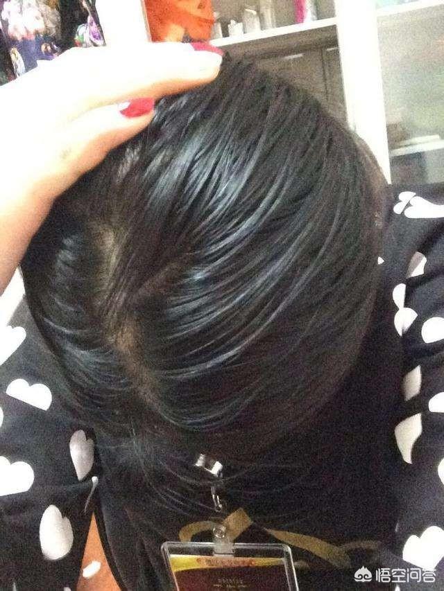 早上洗的头下午就油了,什么牌子的洗发水去油好？