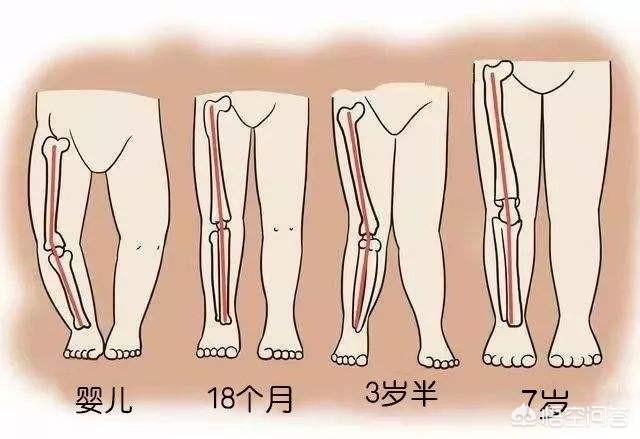 纸尿裤会导致宝宝O型腿吗，哪些原因会导致宝宝的腿发育成o型腿