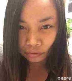 雀斑和黄褐斑:女性长黄褐斑一般和哪些病有关系
