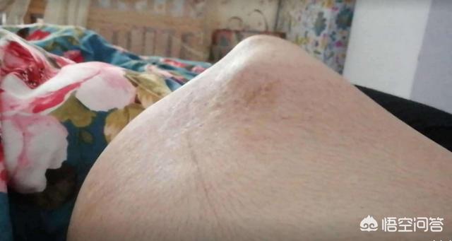 怀孕6个月，孕妇肚子突然一半硬一半软，是胎儿缺氧了吗？该怎么办？插图14