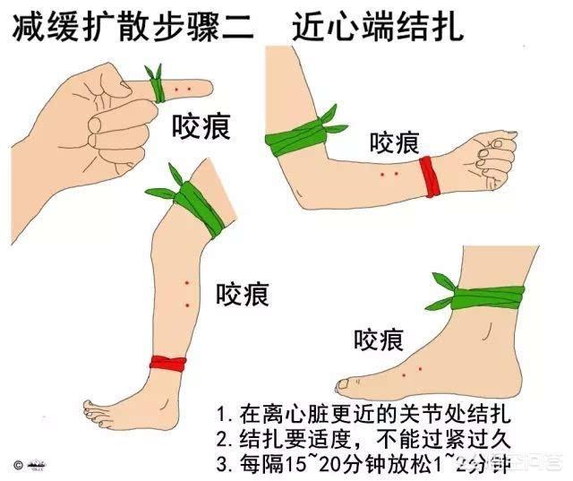 被黑色乌苏里蝮蛇咬了怎么办:被蛇咬了，离医院太远，有什么急救方法？