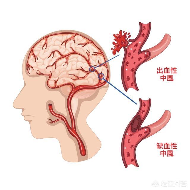 明日大暑，俗话说吃三食、忌三事、防三病，遵三多，身体安康少生病，指的是什么？