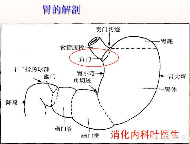 贲门癌早中晚期做胃镜可以看出来吗 准确率高吗 头条问答