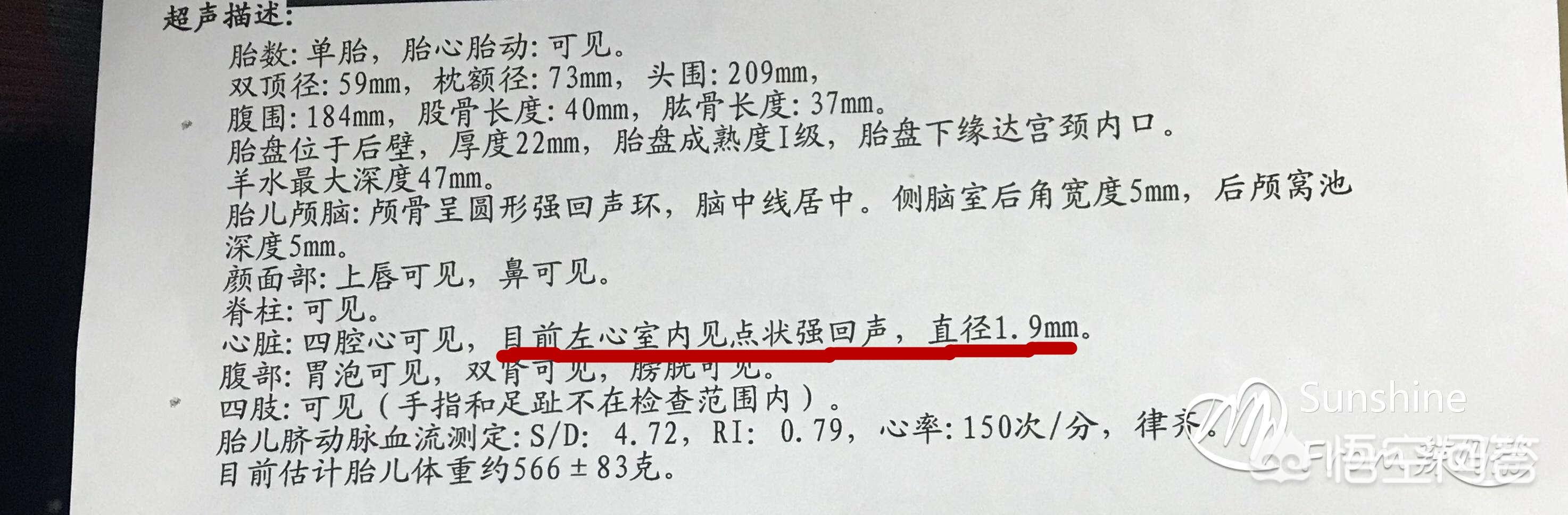 强心脏120306:胎儿心脏彩超多少周做好查出心室强回声是什么原因是畸形吗