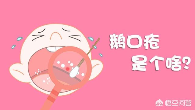 口腔真菌感染是什么原因引起的:宝宝口腔真菌感染是什么引起的 哪些因素导致小儿鹅口疮？